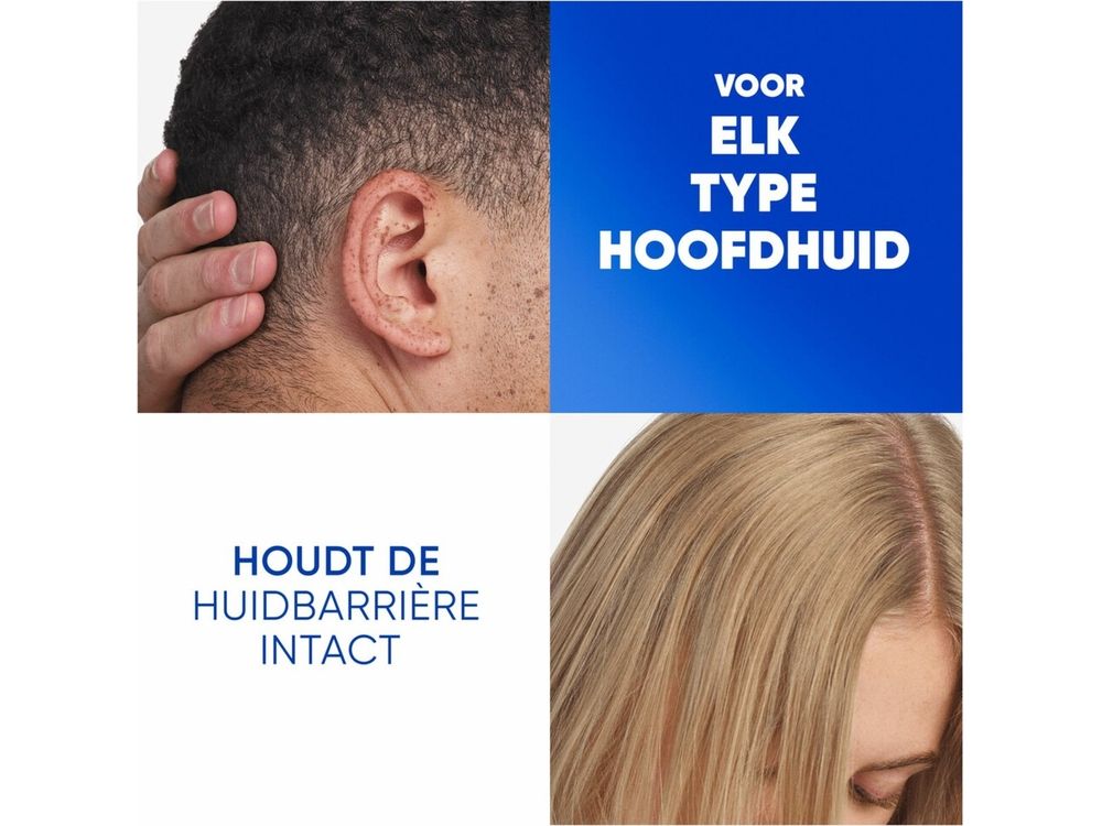 Head&shoulders Shampoo 300 ml 2in1/jeukende Hoofdhuid 3