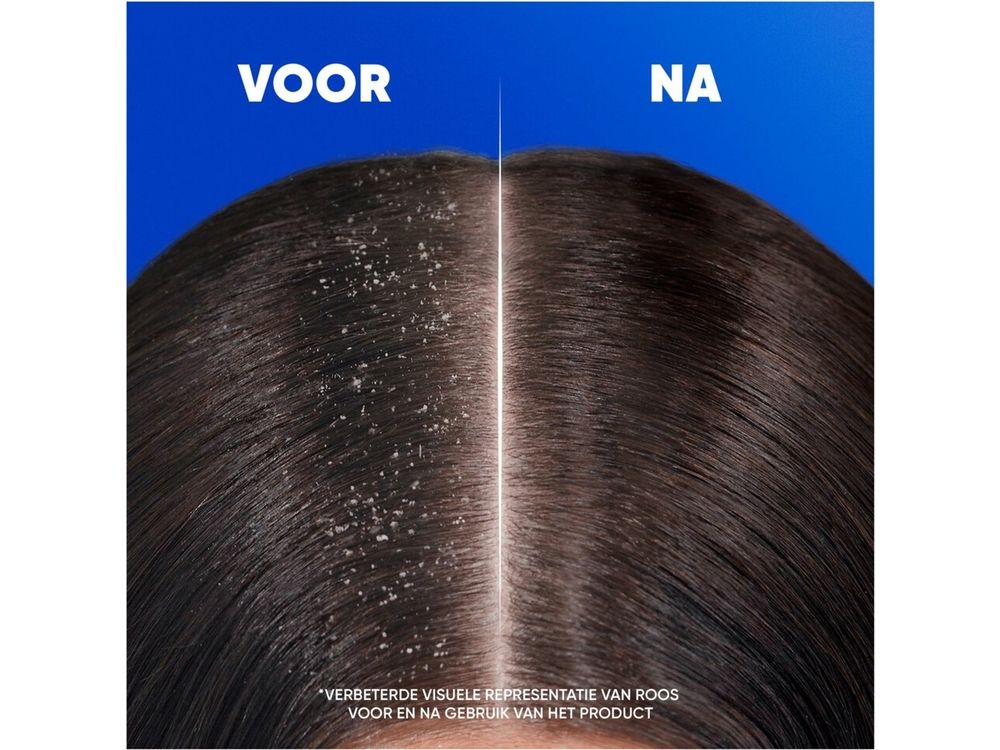 Head&shoulders Shampoo 300 ml 2in1/jeukende Hoofdhuid 4